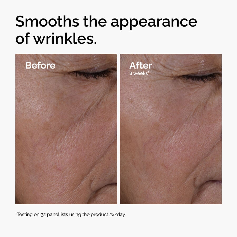Before and after close-up showing the reduction in the appearance of wrinkles after 8 weeks of using Multi-Peptide + HA Serum.